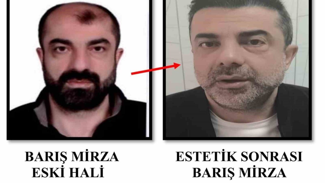 Ameliyat ile yüzünü değiştiren firari cinayet zanlısı, 7 yıl sonra yakalandı